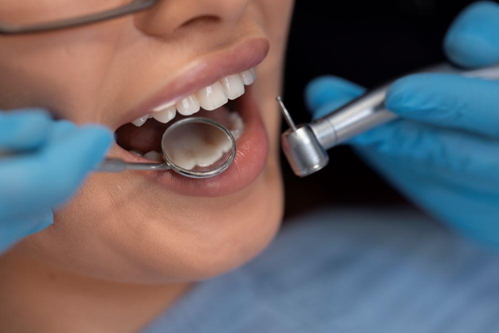 ¿Cuáles son las ventajas de optar por implantes dentales endoóseos?
