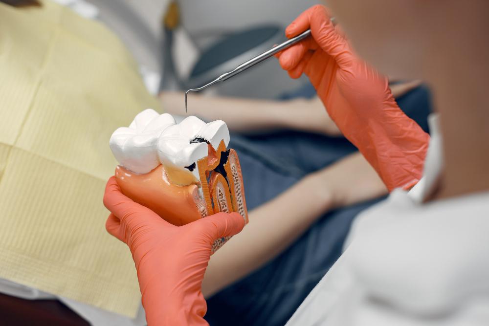 Factores que contribuyen a la formación de cálculos dentales